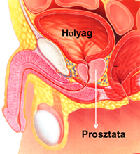 prosztata elhelyezkedese prostatitis éles és krónikus